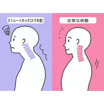 スマホ首